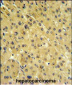 PSMAL Antibody (Center)